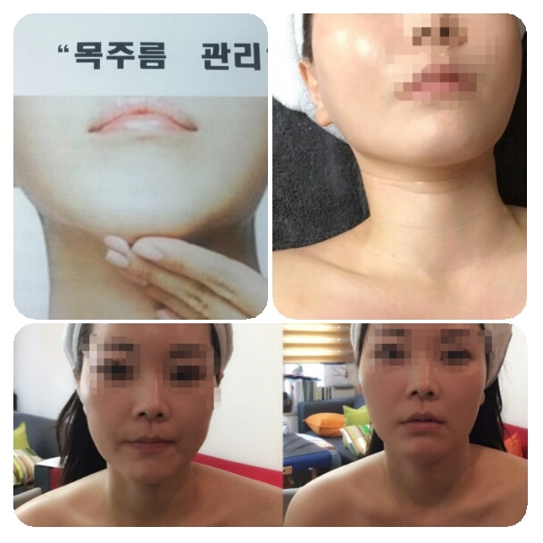  노화의 상징  목주름관리