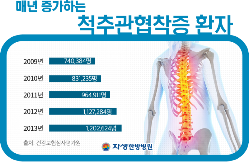 척추협착증, 퇴행성 디스크 증상.파열. 파열. 치료. 약.주사, 임산부 스테로이드 부작용, 허리디스크에 좋은 운동, 임산부 신발, 산후 다이어트 운동.다이어트 신발, 예방, 완치.후기 10