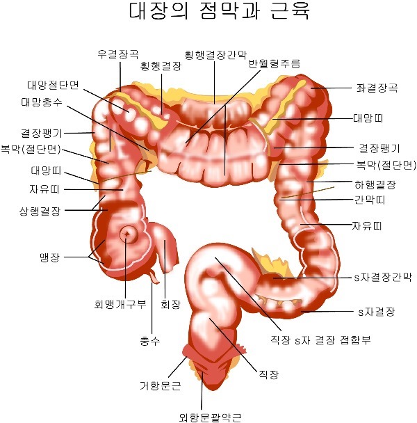 대장암의 증상?