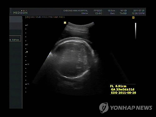 태아 보장 않는 태아보험…금감원, 보험사에 시정요구