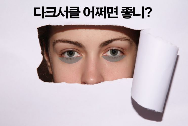  대구피부과추천 다크서클 치료 도와주세요!
