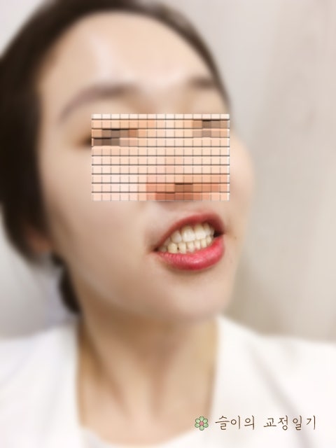 울산치과교정은 후기 맛집으로 4