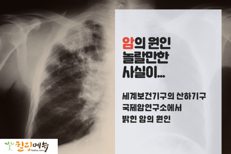 암의 원인?