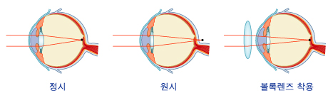오목렌즈 와 볼록렌즈 에대해 / 백석 일산 백석역 홈플러스 아이피아 안경 : 네이버 블로그