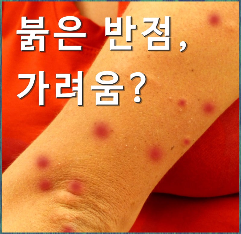 팔에 붉은 반점이 왜 생기는가 9