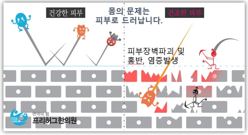 아기 착상 시기와 아기 아토피 원인에 3