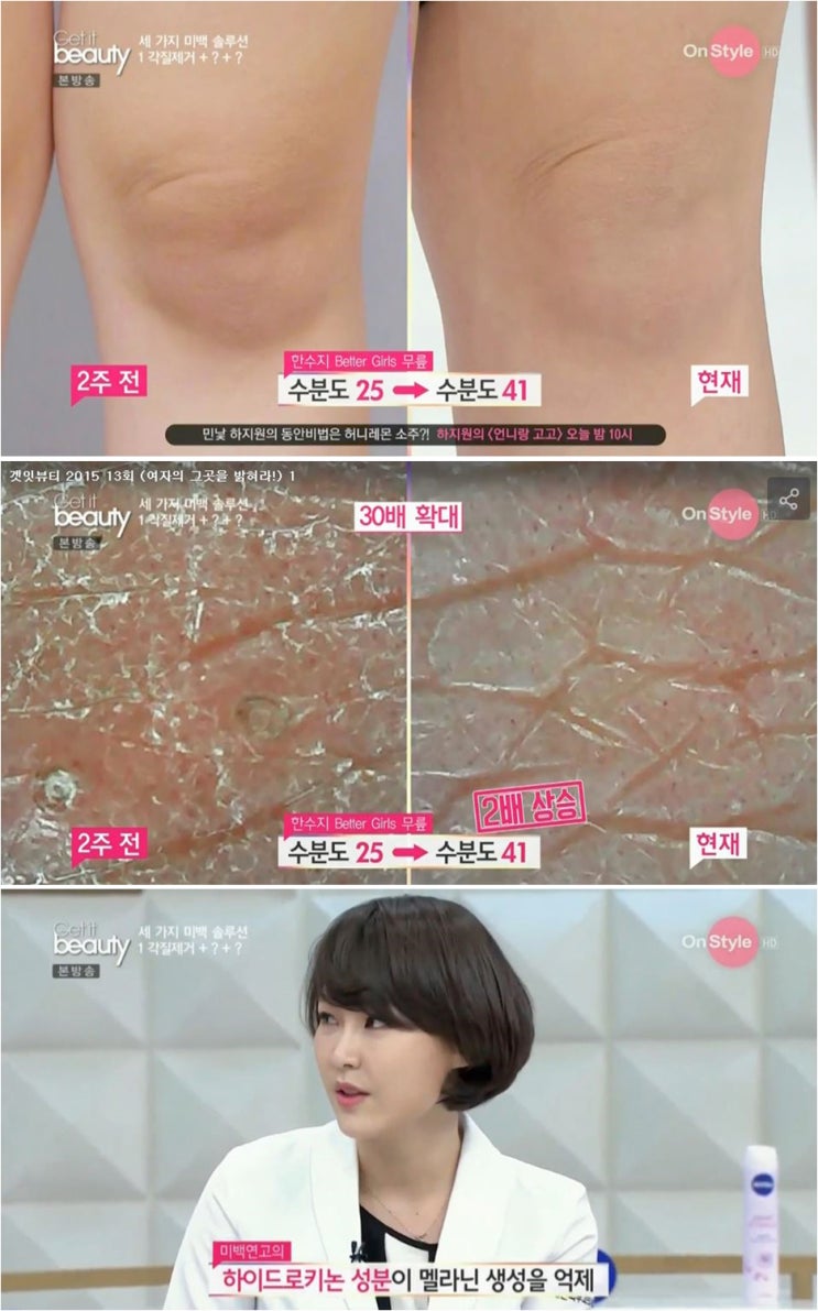 색소침착 미백크림 미백연고 멜라노사크림 : 네이버 블로그