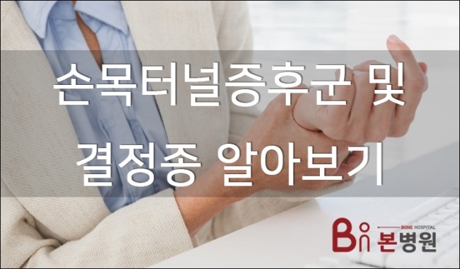 본병원 손목터널증후군 결절종이 뭔가요?