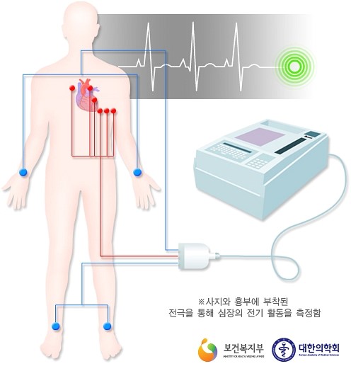 협심증의 증상과 진단방법에 대해 알아볼까요