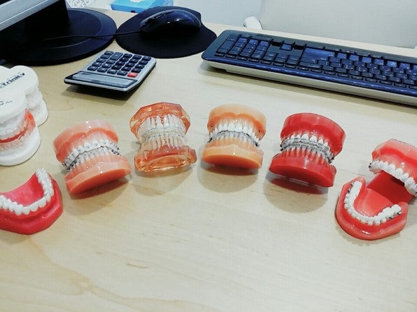 치아교정, 어디까지 알고있니?