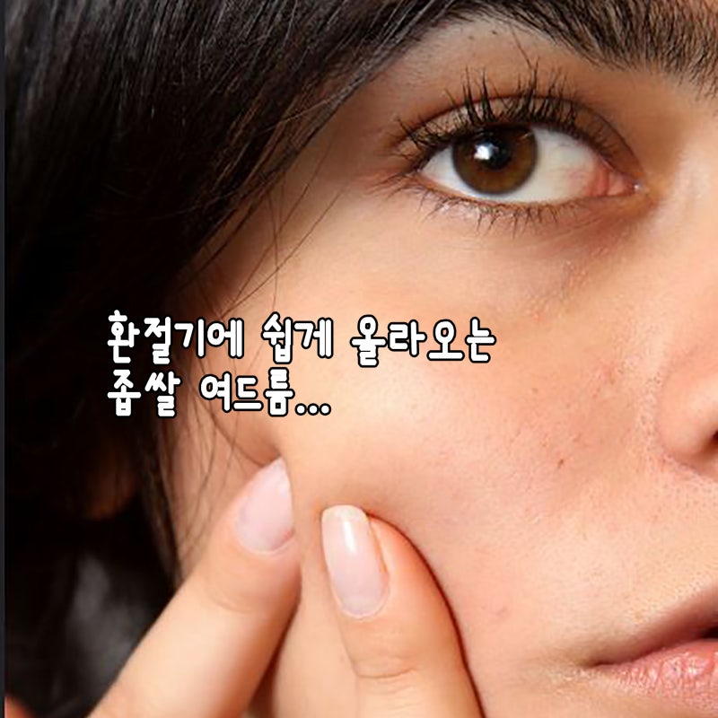 좁쌀여드름 원인 면역력 저하 환절기 8