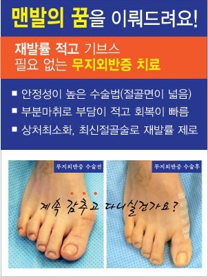 도촌동 정형외과 족부질환의 종류와 증상 및 예방법 5