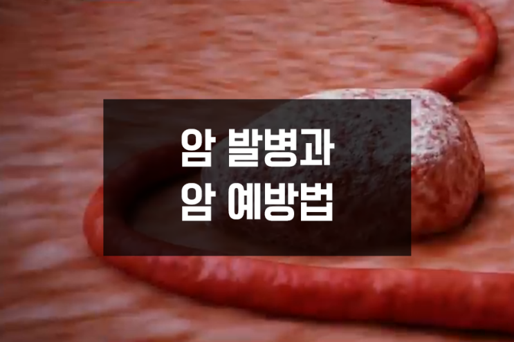 증가하는 암발병 암예방법 알아보기