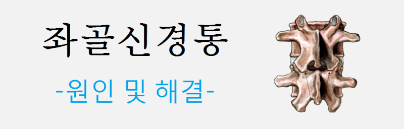 좌골신경통 치료방법 설명 : 네이버 블로그