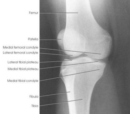 Knee X-ray의 Anatomy와 Positioning : 네이버 블로그