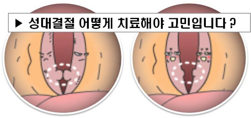 성대구증이란? 성대구증의 원인, 성대구증의 형태에 따른 증상과 치료기간까지~~ 한번에 알아보기 - 다올한의원 산본점