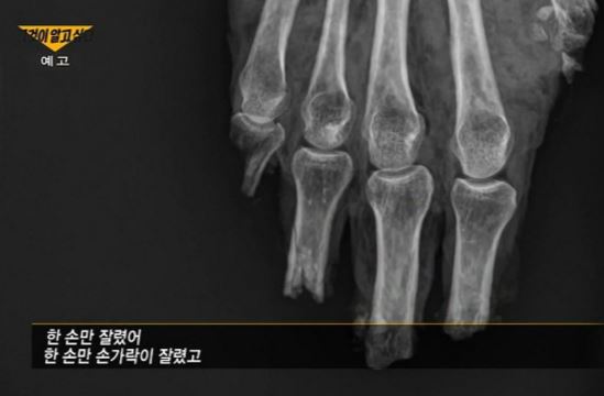 15세 미만 아이는 사망보험에 가입할 수 없는 섬뜩한 이유 (그것이 알고싶다) 15세 미만 아이는 사망보험에 가입할 수 없는 섬뜩한 이유 (그것이 알고싶다)