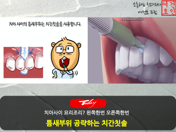 자신의 치간칫솔 사이즈를 알아보고 사용해보세요! 16