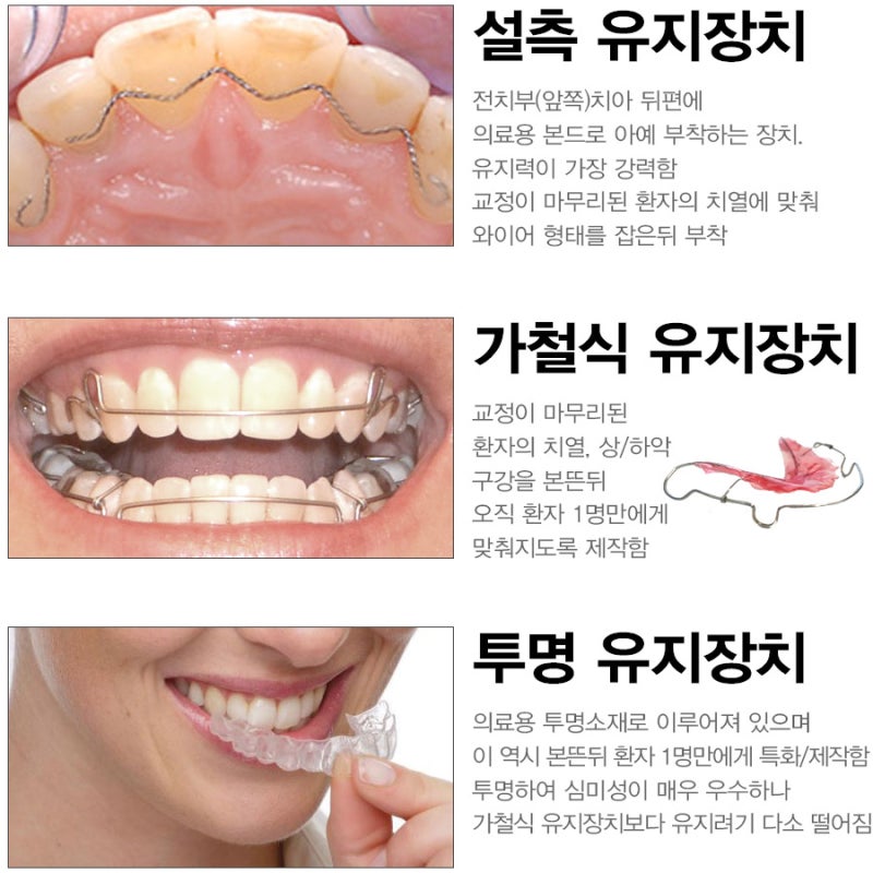관악구치 교정, 유지장치 평생? 2