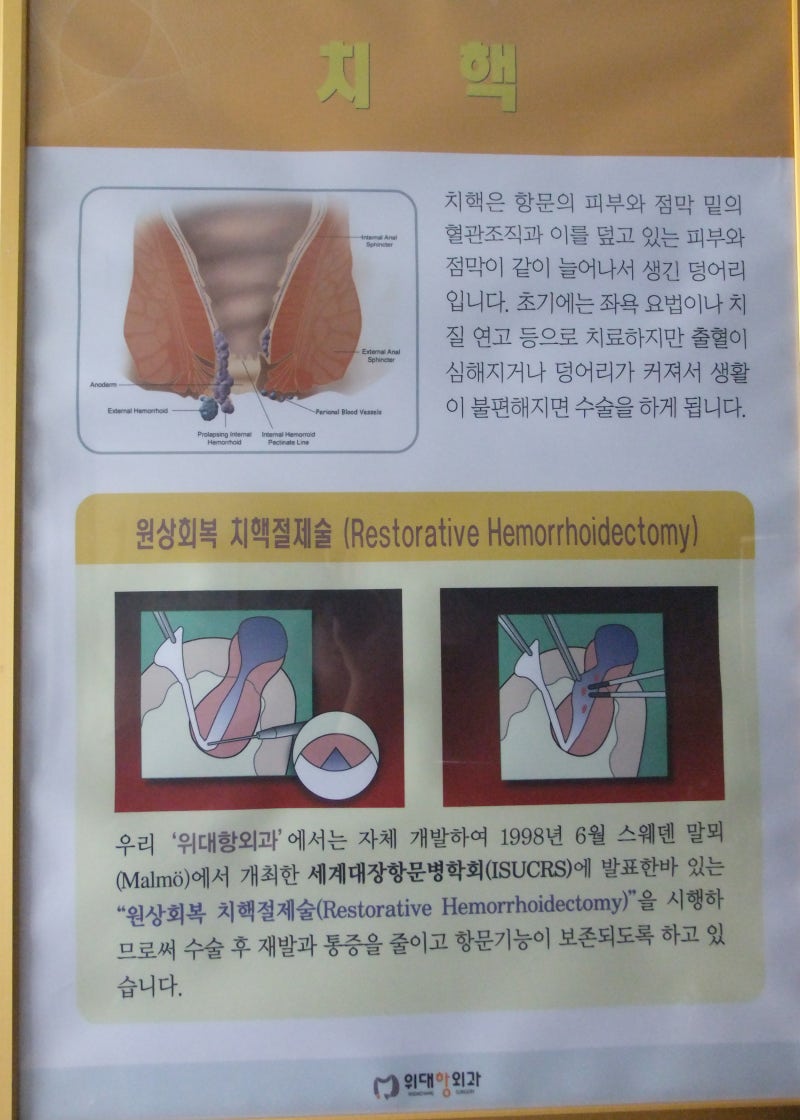 광주치질수술 잘하는 곳 위대항외과 입니다! : 네이버 블로그