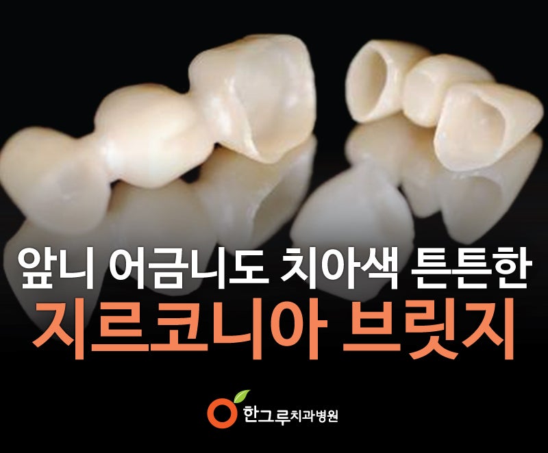 오래된 앞니크라운 제거 후 지르코니아 브릿지에서