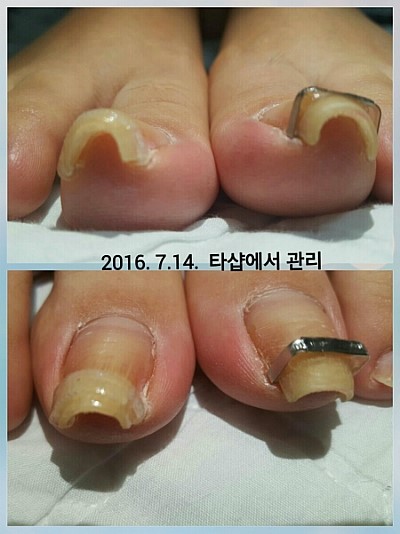 울산에서 용인까지~/분당용인보정동수지죽전네일/주네일