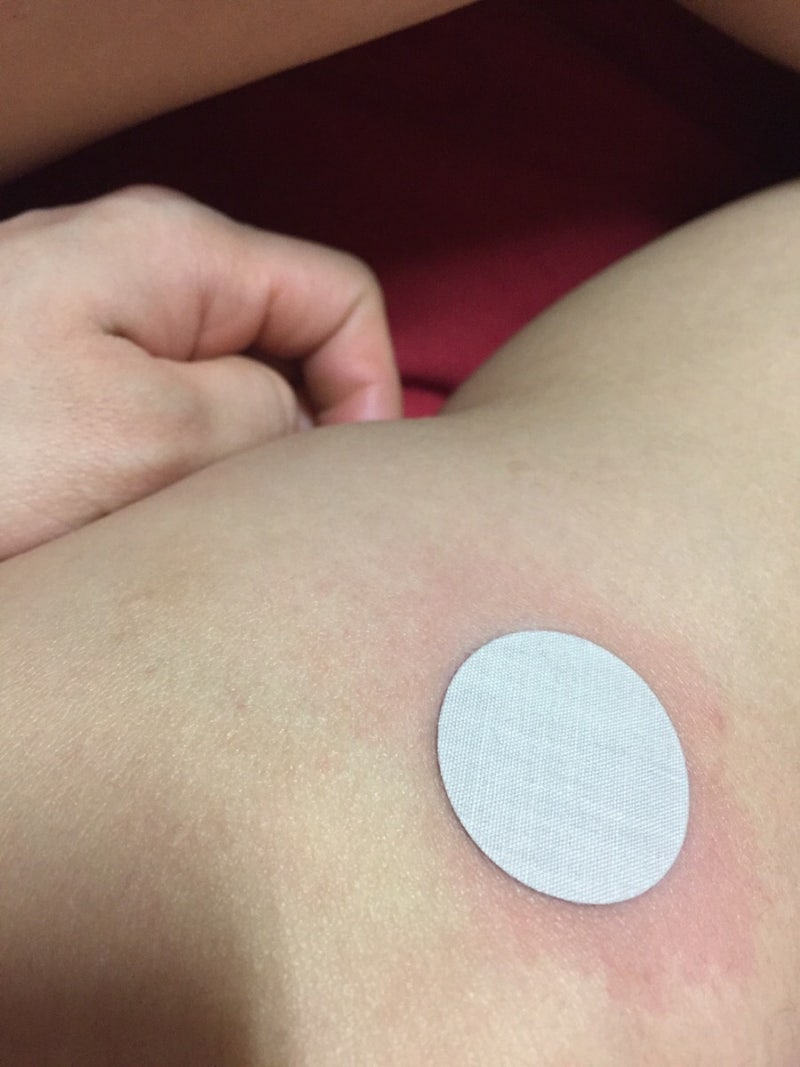 안티푸라민 동전파스 코인플라스타 : 네이버 블로그