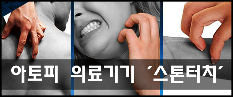  [스톤터치] 휴대용 아토피 의료기기로 습진-가려움증 완화!