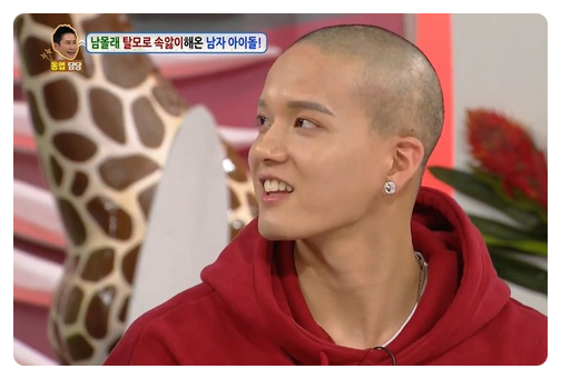프니엘 대머리 너무 안타까운건 사실입니다