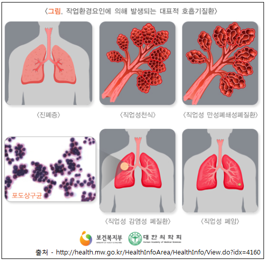 COPD 만성폐쇄성폐질환 증상 및 산재신청
