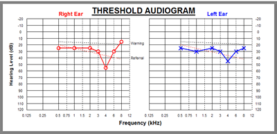 소음속 변별력 2kHz - 4 kHz 역치가 중요함 Brain C. Moore 박사 의견