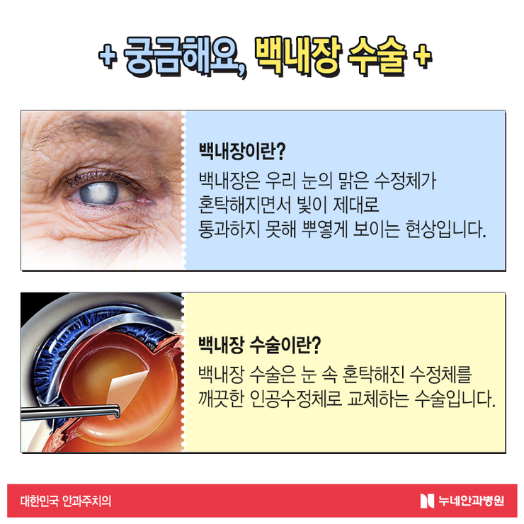 신사역안과 백내장 대한민국 수술 1위 안질환 주의사항 확인해요