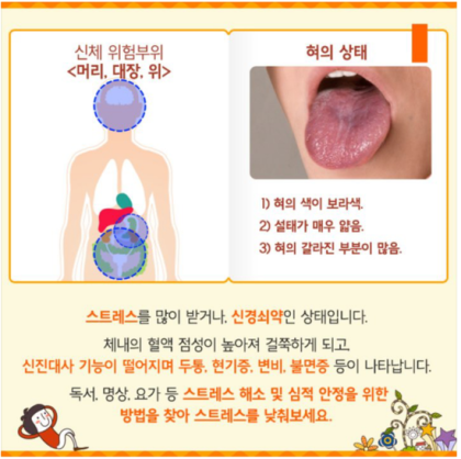 혀가 실룩거리는 증상이 있으면 의심해 보세요