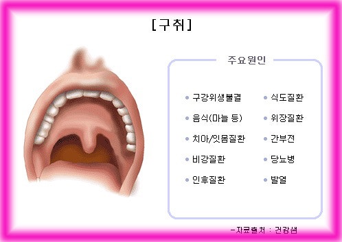남편아! 입냄새제거에 도움이 되는 특히 치약!!! 4