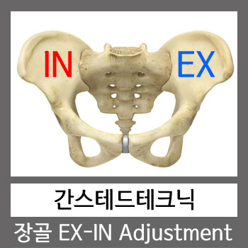 카이로프랙틱 장골 EX - IN