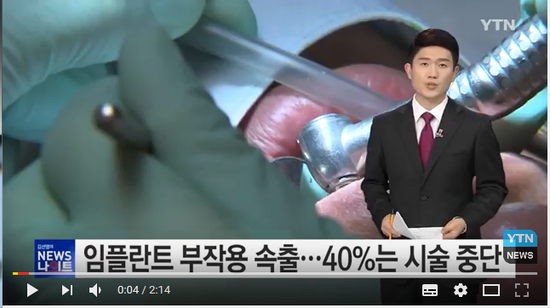 "임플란트 부작용 속출...40%는 시술 중단" / YTN (Yes! Top News) "임플란트 부작용 속출...40%는 시술 중단" / YTN (Yes! Top News)