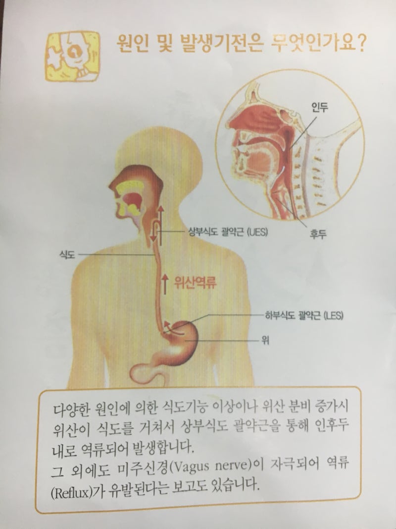 목에 뭔가 걸린 듯 하거나 답답하다, 인후두 위산 역류질환 : 네이버 블로그, image size:800x1067