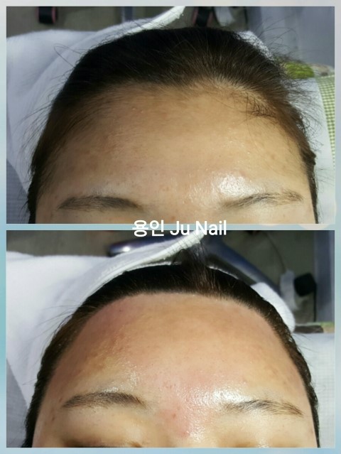 이마헤어라인왁싱/분당용인수지보정죽전동/주네일 이마헤어라인왁싱/분당용인수지보정죽전동/주네일