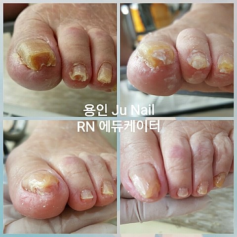 안산글라라의집/분당용인수원수지보정죽전동/주네일 안산글라라의집/분당용인수원수지보정죽전동/주네일