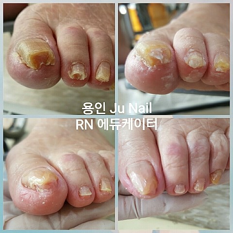 안산글라라의집/분당용인수원수지보정죽전동/주네일