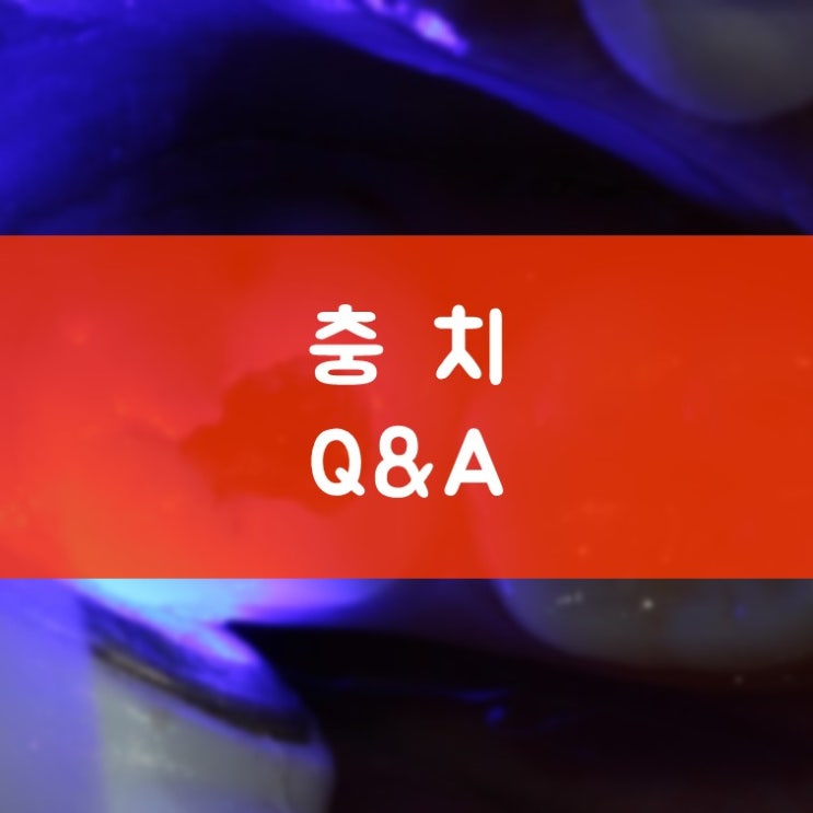 영통구청 충치치료 충치는 어떻게 확인할까요? 충치 맞아요? 충치 진단법