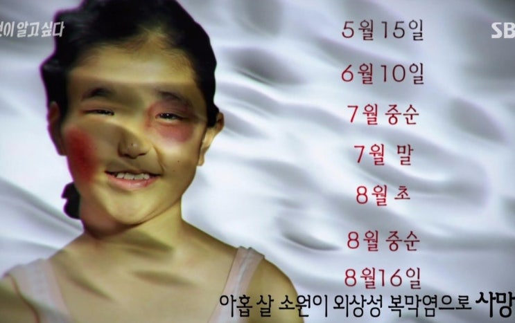  칠곡 계모 아동학대 사망사건, 소원이의 이상한 죽음