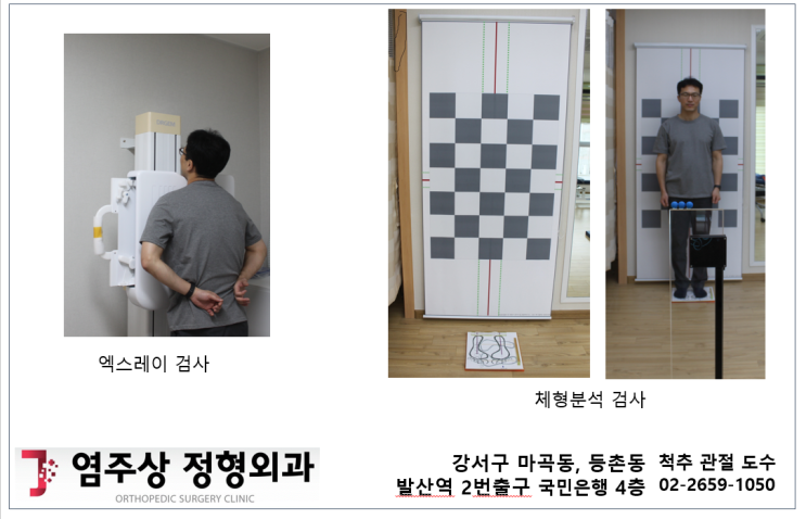  [등촌동 마곡 도수치료] 염주상 정형외과 도수치료의 과학적 프로세스