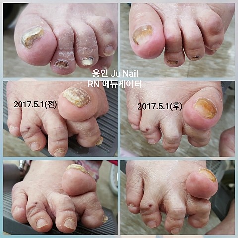 안산 글라라의집/분당용인수지보정죽전동/주네일 안산 글라라의집/분당용인수지보정죽전동/주네일