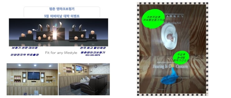  안양보청기-평촌보청기에서 보청기 구입하기