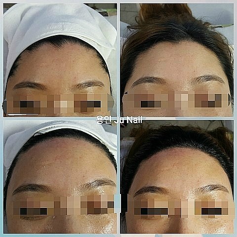 헤어라인왁싱/분당용인수지보정죽전동/주네일 헤어라인왁싱/분당용인수지보정죽전동/주네일