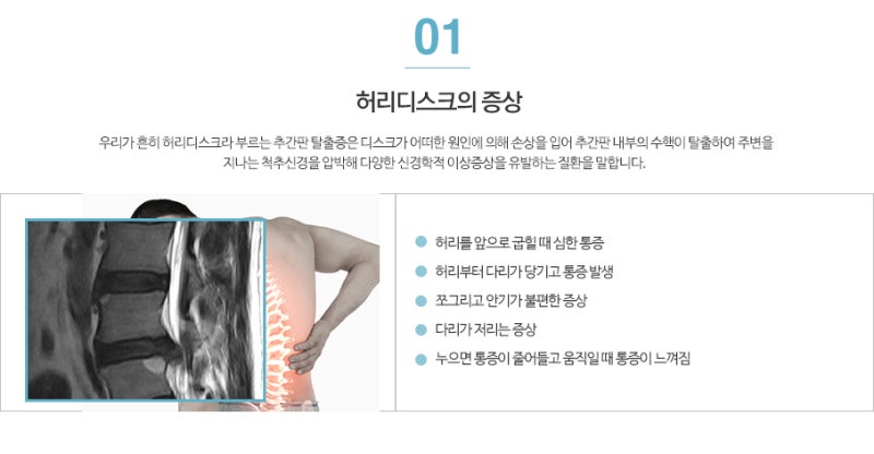 추간판탈출증, 척추병원에서는 허리통증치료 어떻게? 13