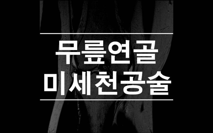 미세천공술을 활용한 무릎연골 복원 recover / 제이본정형외과 권제호