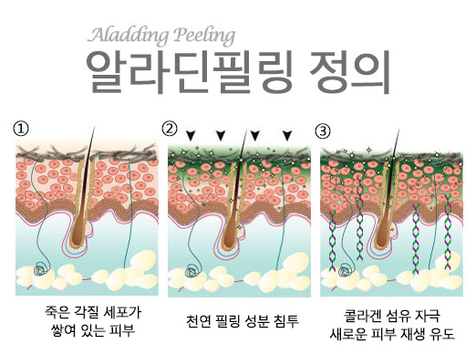 스피큐르엑스알라딘필링셀프박피해조약초필링