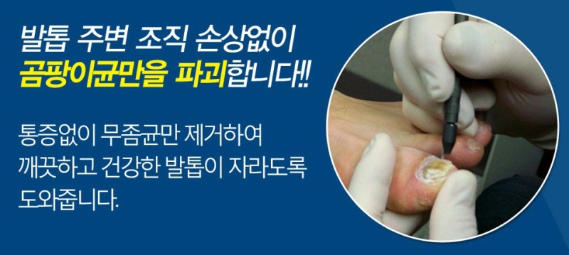 가격 반값 서면 부산 창녕 합천 남지현풍 십이리 용산부곡구포 무좀 내성 손톱 3